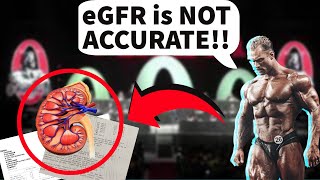 Is eGFR Accurate  Improve Kidney Function In Seconds  Doctors Analysis [upl. by Cristy321]