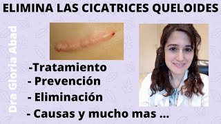 CICATRICES QUELOIDES ▶ Causas prevención y tratamientos ✅ [upl. by Yenalem421]