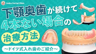 下顎奥歯が続けて4本ない場合の治療方法について〜ドイツ式入れ歯のご紹介〜 [upl. by Ambrosi]