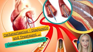 Cardiac Catheterization Purpose Procedure and Recovery [upl. by Colas47]