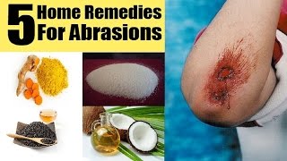 5 Home Remedies for Skin Abrasions  By Top 5 [upl. by Ashley5]