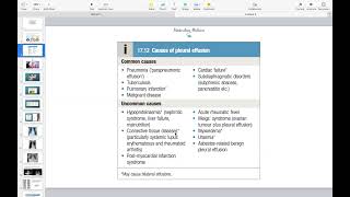 Pleural Effusion Empyema Pneumothorax  Respiratory Course [upl. by Markman552]