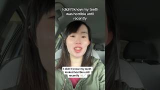 Why This Girl Was BULLIED For Her Teeth 😬🦷 [upl. by Cho]