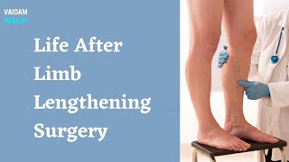 Life After Limb Lengthening Surgery [upl. by Benedicto]