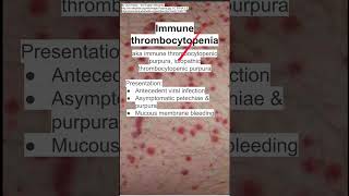 Immune thrombocytopenia [upl. by Anuait]