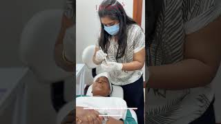 Skin Treatment Melasma amp Pigmentation Chemical Peel [upl. by Adnertal]