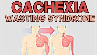 Cachexia  Wasting Syndrome  Explained [upl. by Donall]