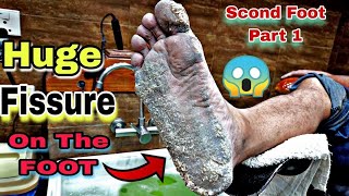 Extreme Dirty Feet Transformation Deep Pedicure Makeover [upl. by Mikey]