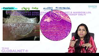 DERMATOPATHOLOGY By Dr Illa jain khandelwal Pathology by Marrow Video Lecture [upl. by Ahselat]