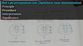 Eleks gel precipitation test  Principle  Procedure  Results  Interpretation  Significance [upl. by Attirehs77]