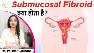 Submucosal Fibroid क्या होता है  How Can Submucosal Fibroid Treated  Types of Fibroids [upl. by Hammel]