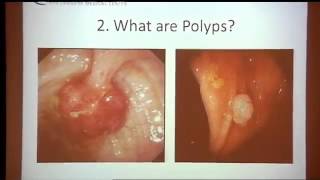 Colorectal Cancer Screening amp Treatment Part 1 of 7 [upl. by Nitsugua]