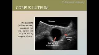 Ultrasound Training Course 08 [upl. by Pandich425]