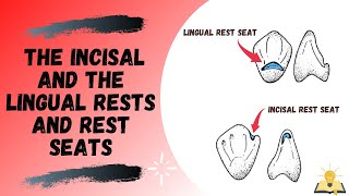 Incisal and the Lingual Rest and Rest Seat  Part III  Removable Partial Denture RPD [upl. by Liarret]