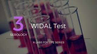 Widal test [upl. by Netsriik]