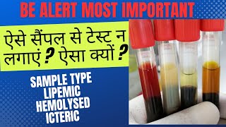 Blood Serum Sample type Lipemic Hemolysed Icteric  ऐसे सैंपल से टेस्ट न लगाएं [upl. by Limoli]