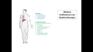 Weitere Indikationen zur Strahlentherapie  Strahlentherapie Prof Hilke Vorwerk [upl. by Chenay135]