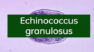 Echinococcus granulosus II Life cycle of Echinococcus granulosus II Morpof Echinococcus granulosus [upl. by Anaigroeg]