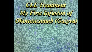 My First Obinutuzumab Gazyva Infusion [upl. by Anwahsak]