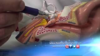 Middle Ear Reconstruction with Dallas Otologist Dr Yoav Hahn [upl. by Aday]