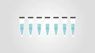 Tips and tricks Phospho Western Blots [upl. by Lakym]