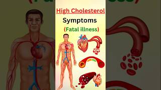 STOP Ignoring These Warning Signs of High Cholesterol [upl. by Moulton]