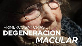 ¿Que es la MACULOPATIA o DEGENERACIÓN MACULAR¿Cuáles son los sintomas Dr Alejandro Lavaque [upl. by Obola]