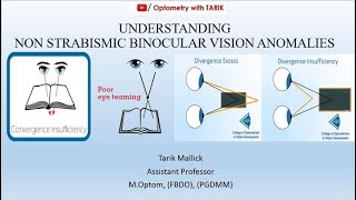 Understanding Non Strabismic Binocular Vision Anomalies [upl. by Omolhs]