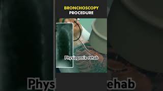 Bronchoscopy procedure shortsviral youtubeshort shortsfeed shortsyoutube youtubevideo youtuber [upl. by Tremayne]