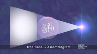 Tomosynthesis  3D Mammogram a New Breast Imaging Technique [upl. by Llertnad426]