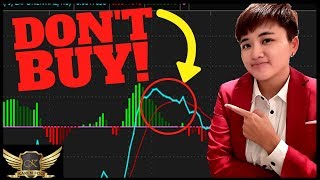 Learn MACD in 30 Minutes  ALL The Basics You Need [upl. by Nonnelg206]