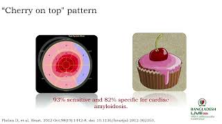 Challenging Cardiomyopathies  Multimodality Imaging to the Rescue by Dr A K M Monwarul Islam [upl. by Suaeddaht]