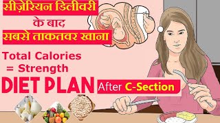 सिजेरियन डिलीवरी के बाद क्या खाये और क्या खाने से बचे  Diet Food After Cesarean Delivery [upl. by Tserof]