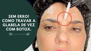 POR QUE ALGUNS BOTOX NA GLABELA quotNÃO PEGAMquot [upl. by Diella]