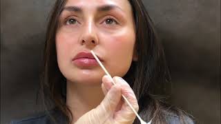 Lip Filler Injection Technique by Dr Tina Ho [upl. by Nosak667]