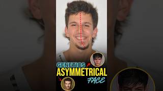 GENETICS Asymmetrical Face [upl. by Norihs]