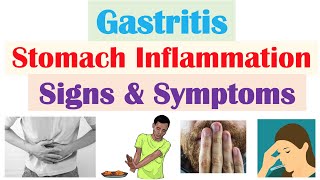 Gastritis Stomach Inflammation Signs amp Symptoms Complications amp Why They Occur [upl. by Eelnyl]