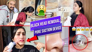 Black Head Removal pore Cleaner Device  blackhead pore vacuum  Does it Work [upl. by Sajet112]