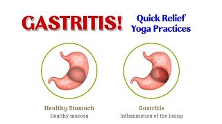 5 Effective Yoga Practices for Gastritis and Chronic Acidity  Triyogam Yoga [upl. by Llenrev]