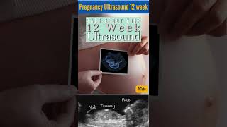 pregnancy week by week development  pregnancy week by week 12 pregnancy ultrasound shorts [upl. by Gebhardt334]