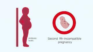 How Rh factor affects a pregnancy [upl. by Hartmunn]