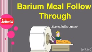 Barium Meal Follow Through  Radiological Procedure  Radiographer [upl. by Ahsiam528]