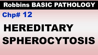 Ch12  Hereditary Spherocytosis  Hemolytic Anemia  Blood Pathology  Dr Asif Lectures [upl. by Letram]