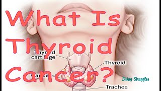 What is Thyroid Cancer [upl. by Avihs]