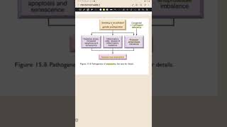 Pathogenesis of Emphysema [upl. by Cornelie]