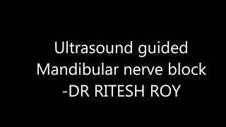 Ultrasound sound guided mandibular and maxillary nerve block [upl. by Daigle]