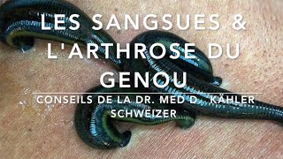 Les sangsues amp larthrose du genou Conseils de la Dr Med Kähler Schweizer Par M DRAKE [upl. by Skricki970]