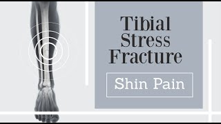 front shin pain  tibial stress fracture [upl. by Kenleigh]