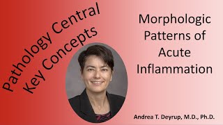 Medical School Pathology Morphologic Patterns of Acute Inflammation [upl. by Ahsitam]