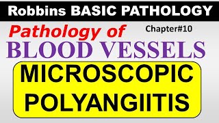 Ch10  MICROSCOPIC POLYANGIITIS  Blood Vessel Pathology  Robbins Lectures [upl. by Ziana]